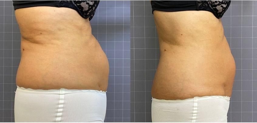 Abdomen 1 (2 seances)